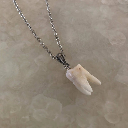 Human Molar Pendant Necklace
