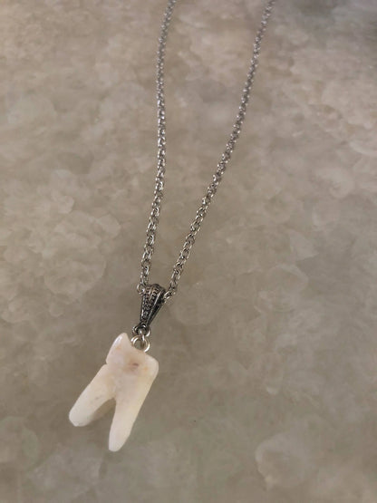 Human Molar Pendant Necklace