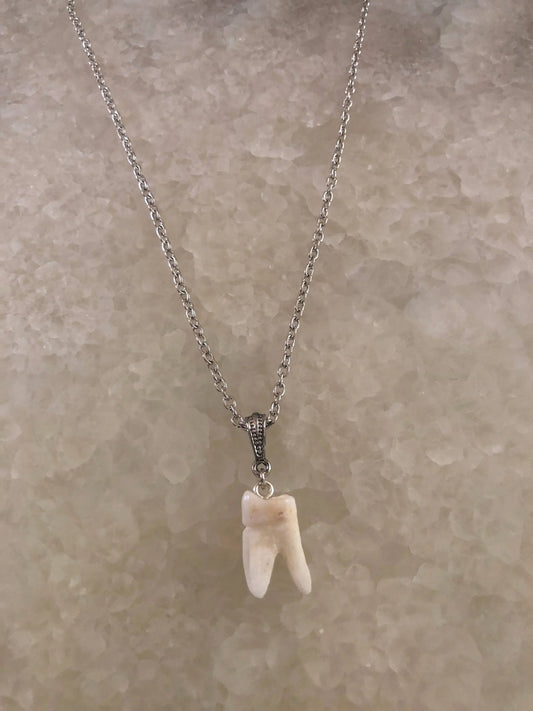 Human Molar Pendant Necklace