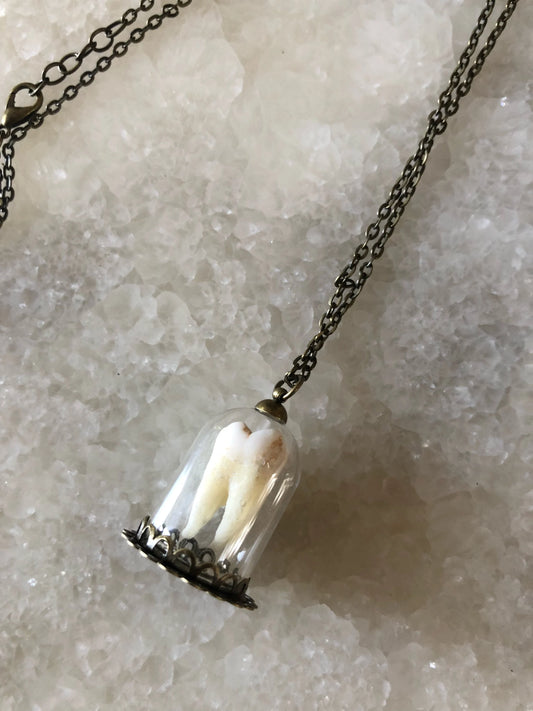 Human Molar Bell Jar Necklace