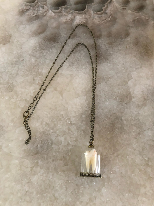 Human Molar Bell Jar Necklace