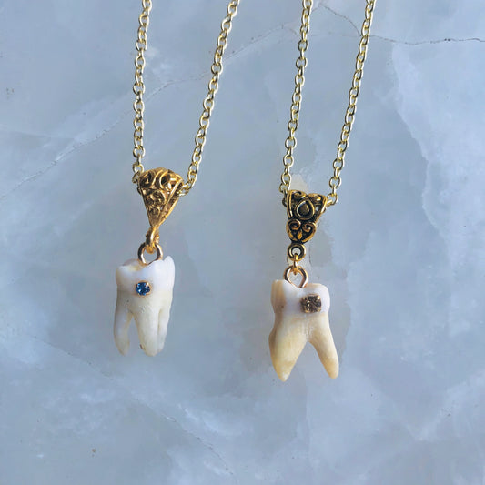 Gold Crystal Cavity Molar Necklace