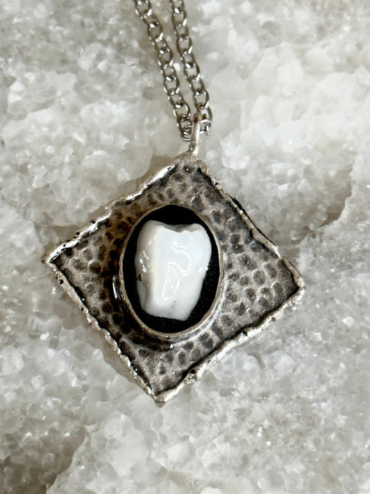Human Molar Resin Necklace