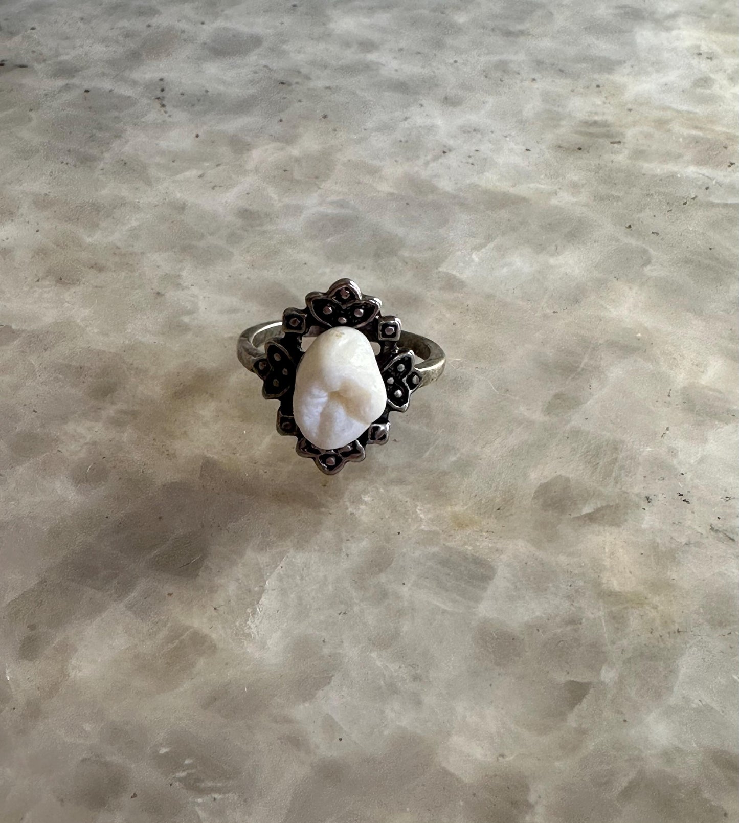 lovely molar ring